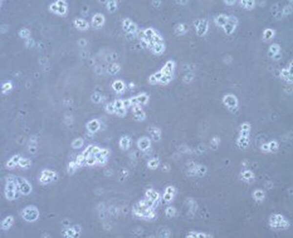 D425 Med Human Medulloblastoma Cell Line | SCC290